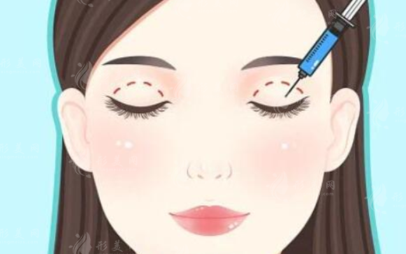 重慶藝星整形做雙眼皮多少錢？好評醫(yī)生信息、案例品鑒、收費表