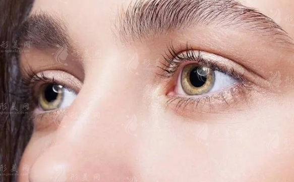 雙眼皮和開眼角會留疤嗎？注意事項有哪些？