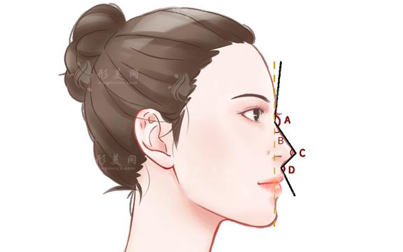 廈門(mén)海峽做鼻子怎么樣？坐診醫(yī)生介紹、隆鼻反饋、收費(fèi)表