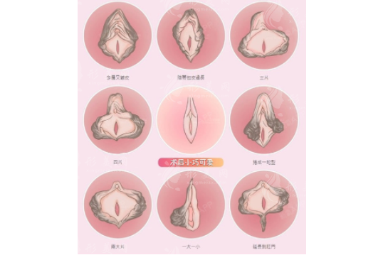 廣州曙光整形醫(yī)院做私密手術(shù)好嗎？郝衛(wèi)潔|張小蕓技術(shù)有保障