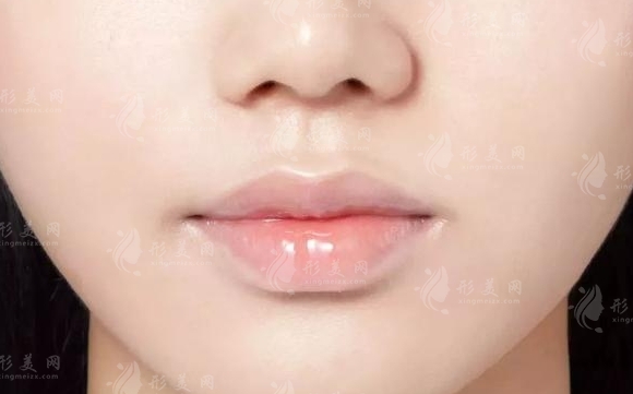 豐唇手術(shù)的方法及其安全性——以玻尿酸豐唇珠為例