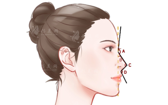 杭州薇琳做隆鼻怎么樣？坐診醫(yī)生\熱門項目\收費價格一覽~