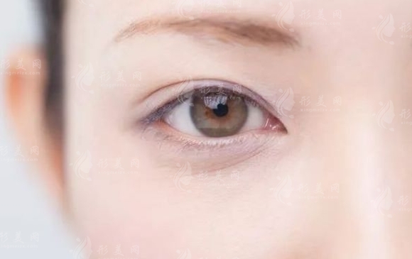 眼瞼吸脂會(huì)導(dǎo)致皮膚下垂嗎？下垂怎么辦？