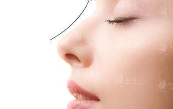 縮小鼻子的方法及其潛在風(fēng)險(xiǎn)