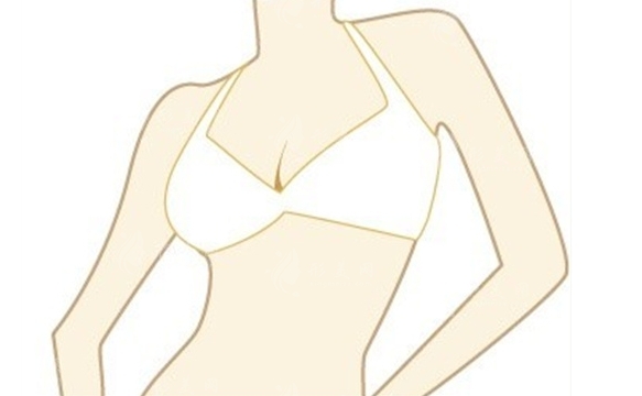 乳暈縮小手術(shù)：效果與乳房影響探究