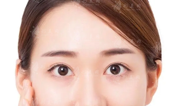 豐額頭手術(shù)的后遺癥及效果維持時間
