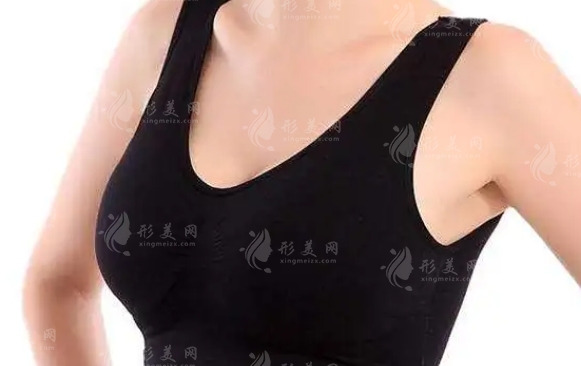 乳暈整形:解讀乳暈擴(kuò)大現(xiàn)象與整形手術(shù)