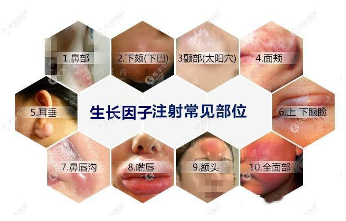 北京黎星取生長(zhǎng)因子價(jià)位多少？