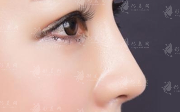 防止耳軟骨墊鼻尖被吸收的全面策略