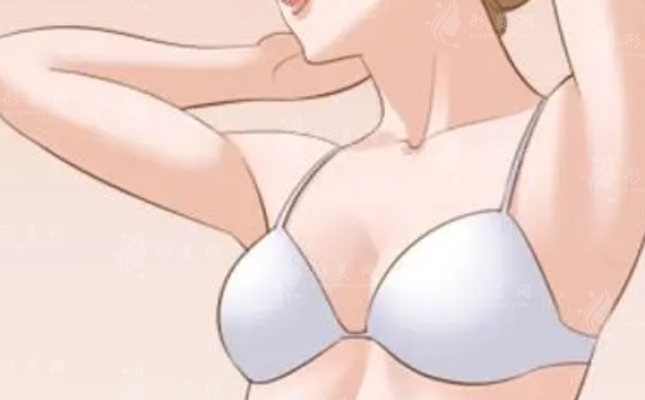 胸部下垂與乳房松弛的應(yīng)對(duì)策略