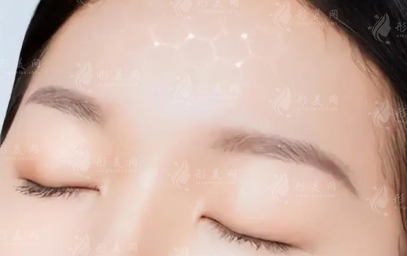 探索注射玻尿酸豐額頭恢復(fù)期：從腫脹到自然的蛻變之旅