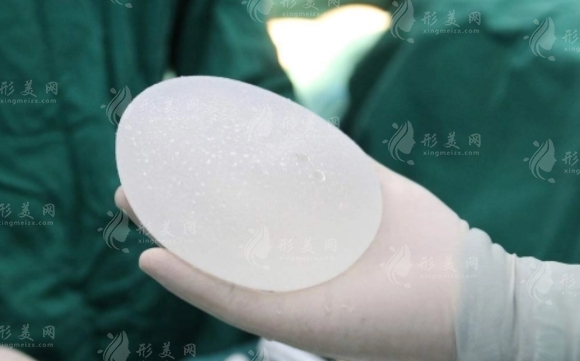 探討隆胸假體不合格滲漏的修復(fù)可能性 探討隆胸假體不合格滲漏的修復(fù)可能性