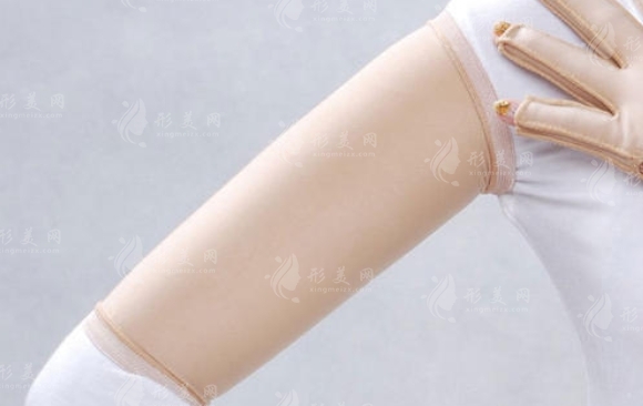手臂吸脂后腫脹消退的時間探討