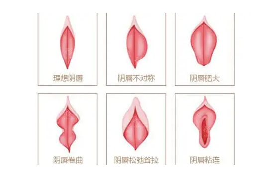 上海虹橋醫(yī)院私密整形科縮陰術優(yōu)勢介紹