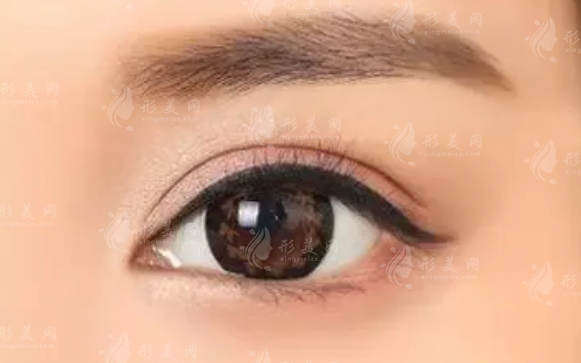 切眉后可以熬夜嗎?切眉后熬夜的潛在影響分析 切眉后可以熬夜嗎?切眉后熬夜的潛在影響分析