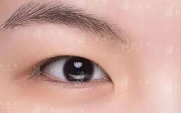 不同類型的腫眼泡及其調(diào)節(jié)方法 不同類型的腫眼泡及其調(diào)節(jié)方法