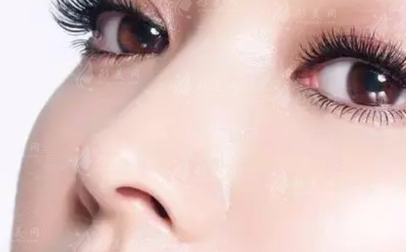 肋軟骨隆鼻保持多久時(shí)間？會(huì)變形嗎？