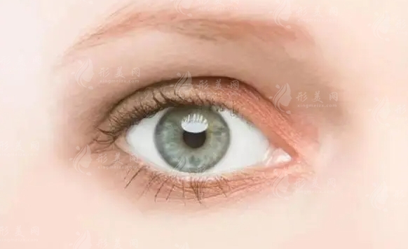 眼窩凹陷的原因及填充手術(shù)探討 眼窩凹陷的原因及填充手術(shù)探討