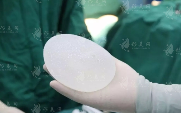 隆胸假體：毛面與光面的區(qū)別