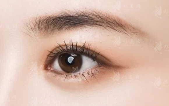 提眉術(shù)與切眉術(shù):揭秘兩者的異同 提眉術(shù)與切眉術(shù):揭秘兩者的異同