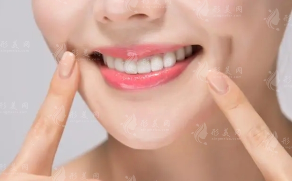 人造酒窩：美麗與技術的完美結合