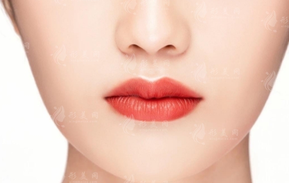 玻尿酸豐唇的費(fèi)用與效果：避免“香腸嘴”的秘訣