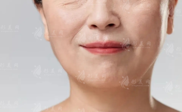埋線除皺后多久能洗臉及其優(yōu)點(diǎn)解析
