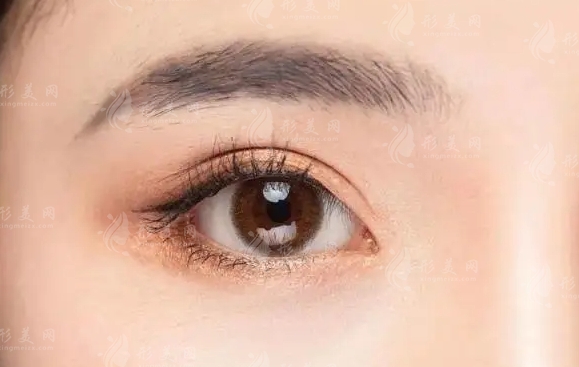 眼窩凹陷填充手術(shù)方式詳解