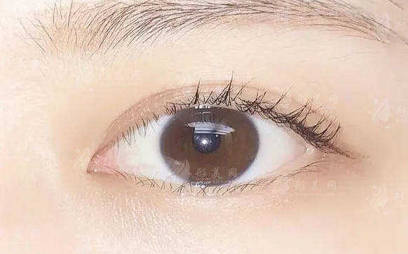 什么眼型適合內(nèi)眼角，什么眼型適合開外眼角