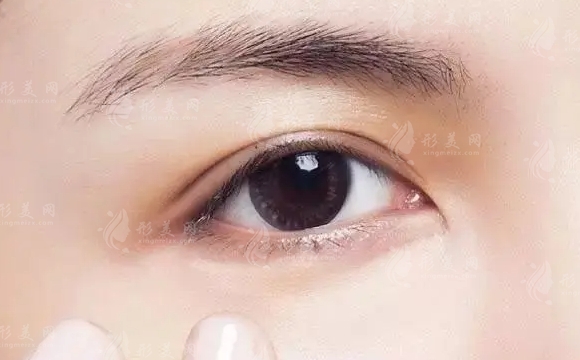 自體脂肪填充淚溝的維持時(shí)間：決定因素解析