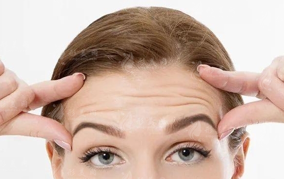 抬頭紋能否徹底去除？減輕抬頭紋的方法有哪些？