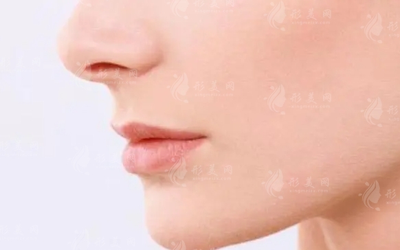 鼻翼缺陷修復(fù)的優(yōu)缺點(diǎn)分析 鼻翼缺陷修復(fù)的優(yōu)缺點(diǎn)分析