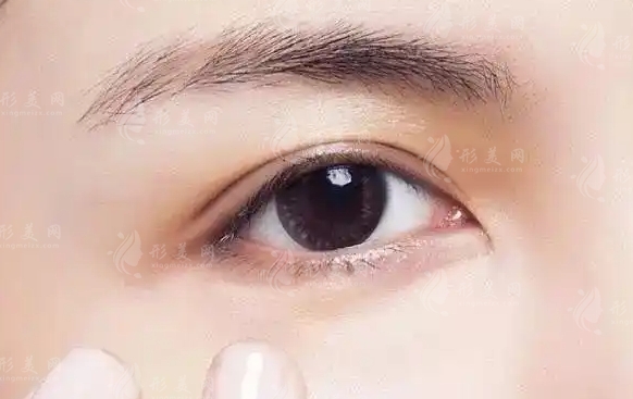 淚溝填充:打針是否為唯一選擇及其優(yōu)勢(shì)探討 淚溝填充:打針是否為唯一選擇及其優(yōu)勢(shì)探討