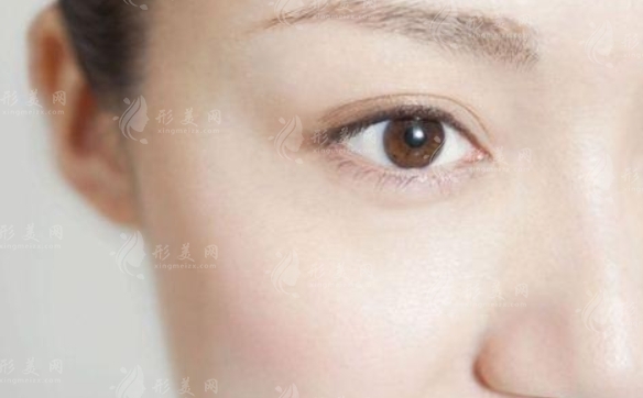 如何快速有效去除眼袋：了解常見眼袋類型及應(yīng)對方法