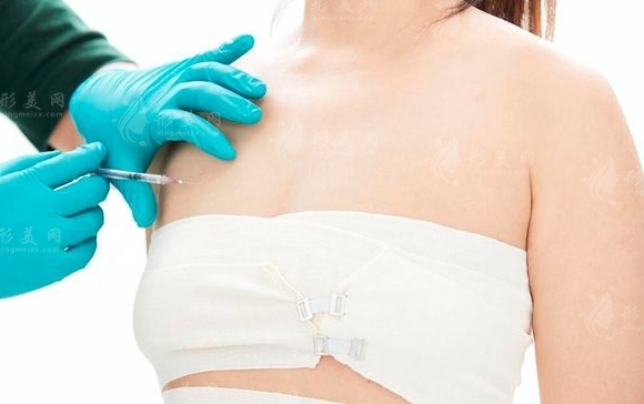 乳房下垂松弛嚴(yán)重怎么辦？矯正費(fèi)用貴嗎？