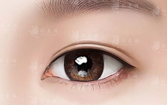 眶隔脂肪釋放術(shù)：價(jià)格與效果維持時(shí)間解析