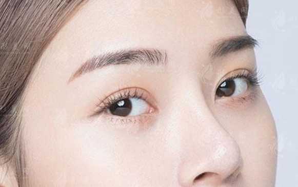 膨體隆鼻感染的癥狀與處理 膨體隆鼻感染的癥狀與處理