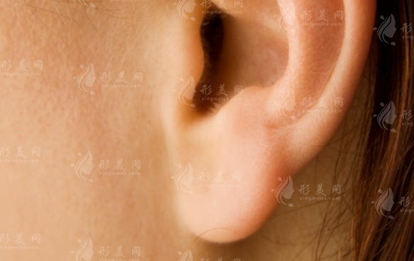 玻尿酸豐耳垂:變軟時(shí)間與注意事項(xiàng)全解析 玻尿酸豐耳垂:變軟時(shí)間與注意事項(xiàng)全解析