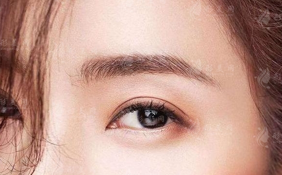 膨體隆眉弓：會(huì)移位嗎？有哪些風(fēng)險(xiǎn)？