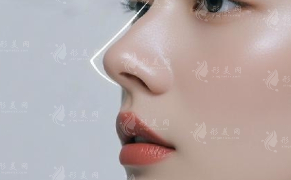 隆鼻手術(shù)后會面臨鼻頭攣縮的問題嗎？