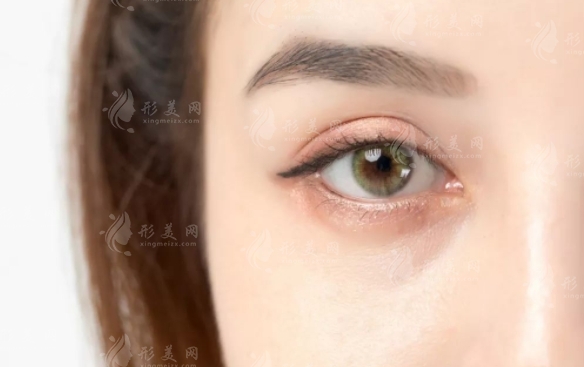 眼窩填充脂肪成活率高嗎？手術(shù)前后有哪些注意事項(xiàng)？
