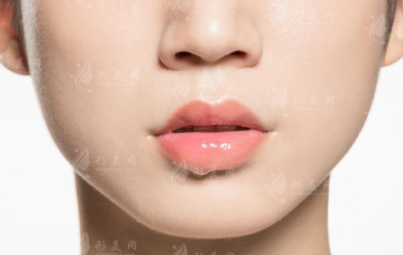 玻尿酸豐唇：大分子還是小分子？多久恢復(fù)自然？