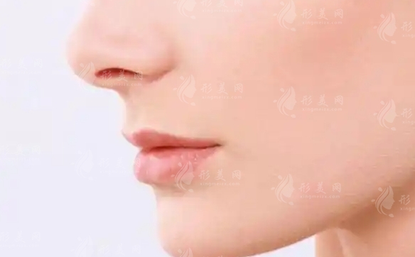 手術(shù)縮鼻頭為何幾乎無痕？疤痕體質(zhì)能否進(jìn)行鼻頭縮小術(shù)？