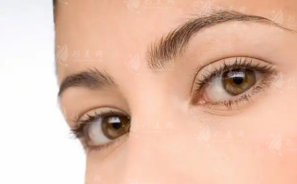內(nèi)眥贅皮雙眼皮手術(shù)價(jià)格及影響因素