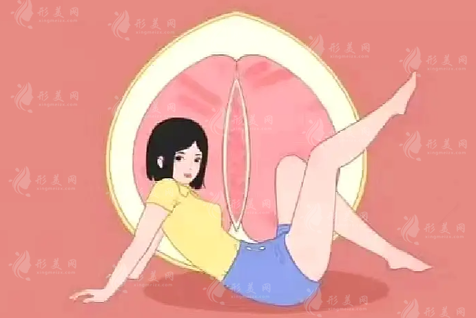 小陰唇整形選哪種形狀好？蝴蝶型水滴型柳葉型效果對比