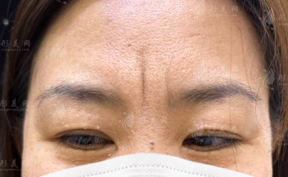 李廣學任沖川字紋技術(shù)PK：誰更適合你？價格揭秘