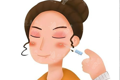 玻尿酸溶解酶多少錢一針？2026價(jià)格表+避坑指南