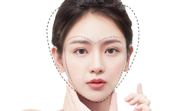 成都曹萍萍輪廓固定怎么樣？注射醫(yī)生技術(shù)全解析