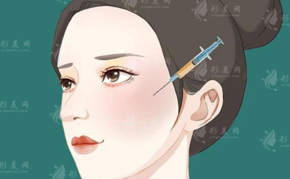 全臉脂肪填充價(jià)格貴嗎?后遺癥&維持時(shí)間揭秘