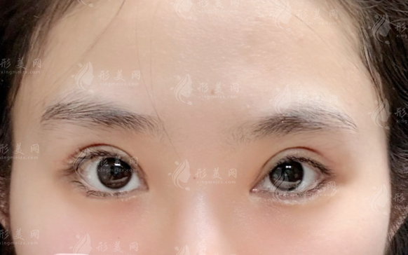 武漢王海平和項(xiàng)利姣眼修復(fù)哪家好？技術(shù)優(yōu)勢(shì)對(duì)比